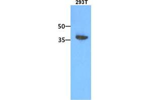 The 293T cell lysate (30ug) were resolved by SDS-PAGE, transferred to PVDF membrane and probed with anti-human ACOT7 antibody (1:1000). (ACOT7 antibody)