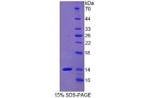 SDS-PAGE analysis of Human Thy1 Protein. (CD90 Protein (THY1))