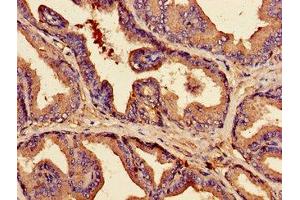 Immunohistochemistry of paraffin-embedded human prostate tissue using ABIN7147903 at dilution of 1:100 (Claudin 3 antibody  (AA 181-220))