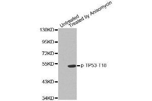 Western blot analysis of extracts from MDA cells, using phospho-TP53-T18 antibody. (p53 antibody  (pThr18))