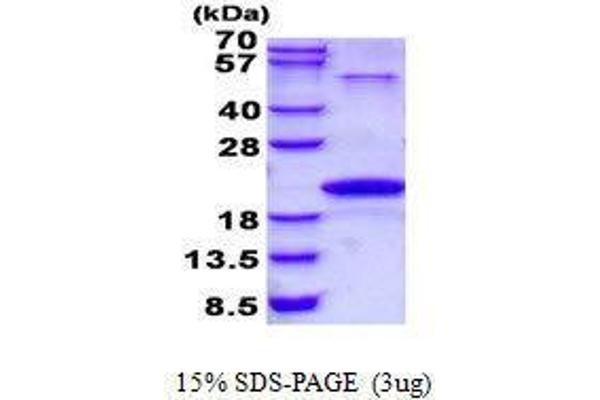 Neurotensin Protein (NTS)