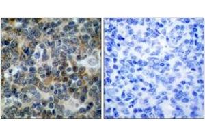 Immunohistochemistry (IHC) image for anti-Vasodilator-Stimulated phosphoprotein (VASP) (pSer238) antibody (ABIN605395) (VASP antibody  (pSer238))