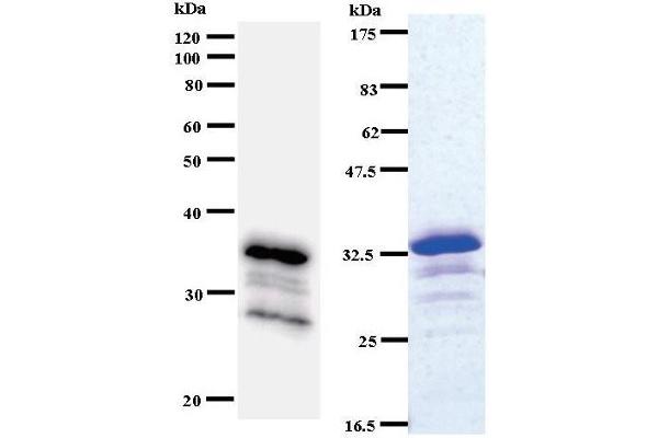 ACIN1 antibody