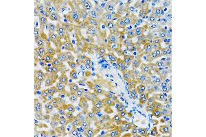 Immunohistochemistry of paraffin-embedded rat liver using HD antibody (ABIN6133742, ABIN6141675, ABIN6141678 and ABIN6213911) at dilution of 1:100 (40x lens). (HDAC5 antibody  (AA 550-650))