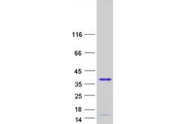 TCEAL3 Protein (Transcript Variant 2) (Myc-DYKDDDDK Tag)