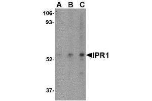 Image no. 1 for anti-SP110 Nuclear Body Protein (SP110) (C-Term) antibody (ABIN1492209) (SP110 antibody  (C-Term))