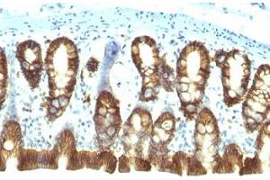 Immunohistochemistry (Formalin-fixed Paraffin-embedded Sections) (IHC (fp)) image for anti-Epithelial Cell Adhesion Molecule (EPCAM) (Cytoplasmic Domain) antibody (ABIN3024725)