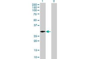 Western Blot analysis of ARGLU1 expression in transfected 293T cell line by ARGLU1 MaxPab polyclonal antibody. (ARGLU1 antibody  (AA 1-273))