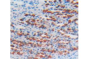 Used in DAB staining on fromalin fixed paraffin- embedded stomach tissue (LOXL2 antibody  (AA 553-761))