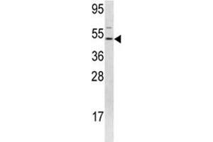 Western blot analysis of FLI1 antibody and 293 lysate. (FLI1 antibody  (AA 52-80))