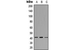 Western blot analysis of SDCCAG8 expression in HEK293T (A), Raw264. (SDCCAG8 antibody  (C-Term))