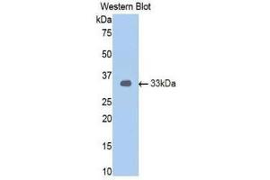 Western Blotting (WB) image for anti-Androgen Receptor (AR) (AA 15-246) antibody (ABIN1174426) (Androgen Receptor antibody  (AA 15-246))