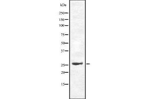 Western blot analysis of Cdc34 using HepG2 whole cell lysates (CDC34 antibody  (Internal Region))