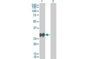 Western Blot analysis of CDKN1B expression in transfected 293T cell line by CDKN1B MaxPab polyclonal antibody. (CDKN1B antibody  (AA 1-198))