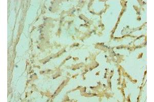 Immunohistochemistry of paraffin-embedded human prostate tissue using ABIN7153096 at dilution of 1:100 (FOXP2 antibody  (AA 416-715))