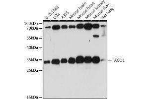 TACO1抗体（AA 1-297）