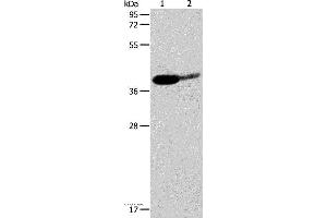 Western blot analysis of Mouse brain and human liver cancer tissue, using SIRT3 Polyclonal Antibody at dilution of 1:500 (SIRT3 antibody)