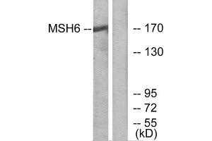 Western Blotting (WB) image for anti-MutS Homolog 6 (E. Coli) (MSH6) (Internal Region) antibody (ABIN1850484) (MSH6 antibody  (Internal Region))