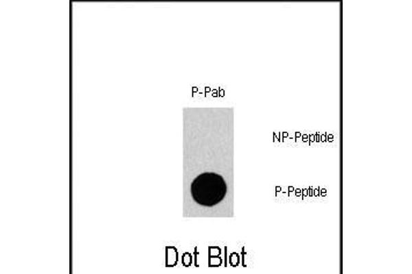 GAB1 antibody  (pTyr659)