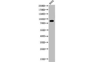 Western Blot analysis of K562 cells using Acetyl-HSP 90 (K292/284) Polyclonal Antibody (HSP9AA1 (acLys284), (acLys292) antibody)