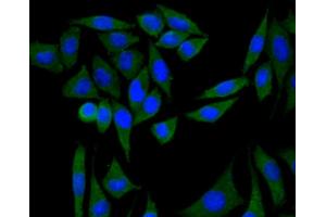 MCF7 cells were fixed with paraformaldehyde, permeabilized with 0. (PIK3R1 antibody)