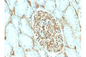 Immunohistochemistry (IHC) image for anti-CD34 (CD34) antibody (ABIN6941175)