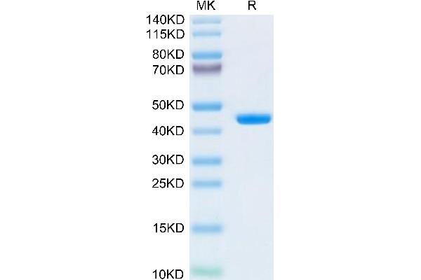 beta-2 Microglobulin Protein (AA 21-119) (Fc Tag)