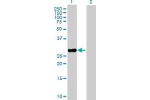 Western Blot analysis of TNNI3 expression in transfected 293T cell line by TNNI3 MaxPab polyclonal antibody. (TNNI3 antibody  (AA 1-210))