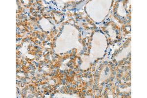 Immunohistochemistry (IHC) image for anti-Aralkylamine N-Acetyltransferase (AANAT) antibody (ABIN2429551) (AANAT antibody)