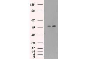 HEK293T cells were transfected with the pCMV6-ENTRY control (Left lane) or pCMV6-ENTRY CD4 (Right lane) cDNA for 48 hrs and lysed. (CD4 antibody)