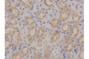 DAB staining on IHC-P; Samples: Mouse Kidney Tissue (Peroxiredoxin 5 antibody  (AA 1-210))