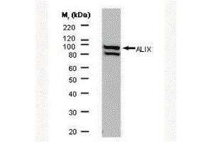 Western Blotting (WB) image for anti-Programmed Cell Death 6 Interacting Protein (PDCD6IP) antibody (ABIN2477348) (ALIX antibody)