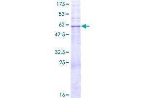 Image no. 1 for Ring Finger Protein 148 (RNF148) (AA 1-305) protein (GST tag) (ABIN1318266) (RNF148 Protein (AA 1-305) (GST tag))