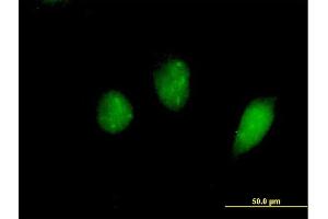 Immunofluorescence of purified MaxPab antibody to FKHL18 on HeLa cell. (FOXS1 antibody  (AA 1-330))