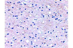 Immunohistochemistry of BRAL1 Antibody Immunohistochemistry of BRAL1 antibody. (HAPLN2 antibody  (Internal Region))