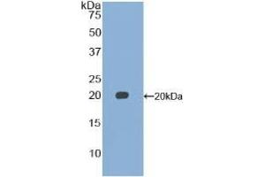 Detection of Recombinant GDF15, Mouse using Polyclonal Antibody to Growth Differentiation Factor 15 (GDF15) (GDF15 antibody  (AA 193-296))