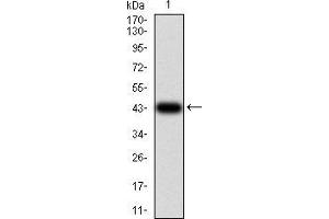 Western blot analysis using IL1RAPL1 mAb against human IL1RAPL1 (AA: 541-694) recombinant protein. (IL1RAPL1 antibody  (AA 541-694))