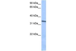 Western Blotting (WB) image for anti-Septin 9 (SEPT9) antibody (ABIN2463467) (Septin 9 antibody)