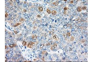 Immunohistochemistry (IHC) image for anti-Eukaryotic Translation Initiation Factor 2 Subunit 1 (EIF2S1) antibody (ABIN1497972) (EIF2S1 antibody)