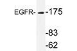 Western blot analyzes of EGFR antibody in extracts from HT-29 cells. (EGFR antibody)
