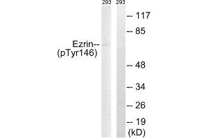 Western Blotting (WB) image for anti-Ezrin (EZR) (pTyr146) antibody (ABIN1847550) (Ezrin antibody  (pTyr146))