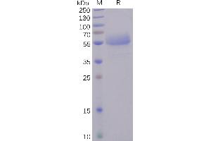 Human ICOS Protein, hFc Tag on SDS-PAGE under reducing condition. (ICOS Protein (AA 21-140) (Fc Tag))