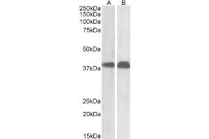 ABIN184618 (0. (SET/TAF-I antibody  (N-Term))