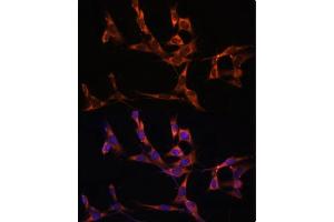 Immunofluorescence (IF) image for anti-Caspase 8 (CASP8) (AA 1-479) antibody (ABIN6137970)