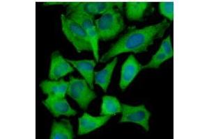 Immunofluorescence (IF) image for anti-Hexokinase 1 (HK1) (AA 1-917), (N-Term) antibody (ABIN317096) (Hexokinase 1 antibody  (N-Term))