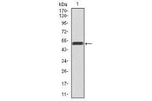 Image no. 1 for anti-Phosphoinositide 3 Kinase, p85 alpha (PI3K p85a) antibody (ABIN1490987) (PIK3R1 antibody)