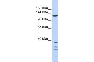 TNKS antibody used at 1 ug/ml to detect target protein. (TNKS antibody  (Middle Region))