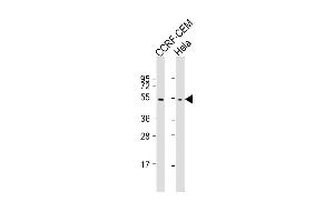 Lane 1: CCRF-CEM cell lysate (20ug), Lane 2: HeLa cell lysate (20ug) probed with bsm-51009M TBB1 (86CT4. (TUBB1 antibody)