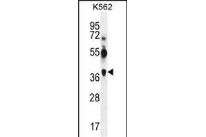 MAGEA12抗体（N-末端）