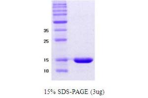 SDS-PAGE (SDS) image for alpha Synuclein DeltaNAC (AA 61-95) protein (ABIN666814) (alpha Synuclein DeltaNAC (AA 61-95) Protein)